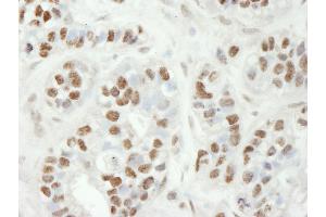 anti-Zinc Finger CCCH-Type Containing 11A (ZC3H11A) (AA 700-750) antibody