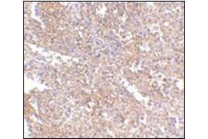 Immunohistochemistry of RAP80 in human spleen tissue with this product at 2. (UIMC1 antibody  (C-Term))