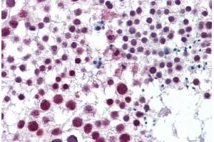 Human Testis: Formalin-Fixed, Paraffin-Embedded (FFPE) (Cyclin H antibody  (AA 1-110))