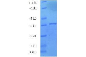 SDS-PAGE (SDS) image for Antigen Identified By Monoclonal Antibody Ki-67 (MKI67) (AA 2962-3254), (partial) protein (His tag) (ABIN4976318) (Ki-67 Protein (AA 2962-3254, partial) (His tag))