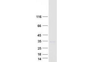 Western Blotting (WB) image for Fibroblast Growth Factor 14 (FGF14) (Transcript Variant 1) protein (Myc-DYKDDDDK Tag) (ABIN2721061)
