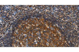 Immunohistochemistry of paraffin-embedded Human tonsil using GNA13 Polyclonal Antibody at dilution of 1:30 (GNA13 antibody)