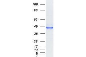 Western Blotting (WB) image for Cathepsin L1 (CTSL1) (Transcript Variant 1) protein (Myc-DYKDDDDK Tag) (ABIN2713238)