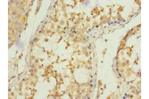 Immunohistochemistry of paraffin-embedded human testis tissue using ABIN7148605 at dilution of 1:100 (CORO1C antibody  (AA 375-474))