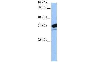 WB Suggested Anti-MRPL24  Antibody Titration: 0.