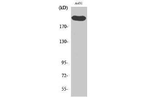 Western Blotting (WB) image for anti-Extra Spindle Poles Like 1 (ESPL1) (Tyr489) antibody (ABIN3180309) (Separase antibody  (Tyr489))