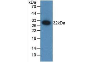 Detection of Recombinant F12, Mouse using Polyclonal Antibody to Coagulation Factor XII (F12) (F12 antibody  (AA 352-587))