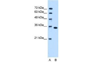 WB Suggested Anti-TYMS Antibody Titration:  0.