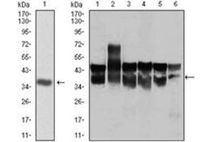 Western Blotting (WB) image for anti-Cyclin-Dependent Kinase 2 (CDK2) antibody (ABIN1106645) (CDK2 antibody)