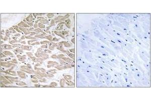 Immunohistochemistry analysis of paraffin-embedded human heart tissue, using RAD Antibody. (RRAD antibody  (AA 41-90))