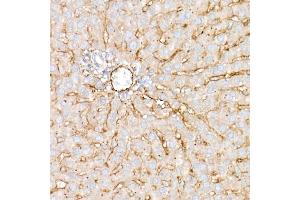 Immunohistochemistry (IHC) image for anti-CD81 (CD81) (AA 1-100) antibody (ABIN6138231)