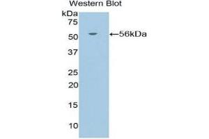 Western Blotting (WB) image for anti-Nuclear Receptor Subfamily 3, Group C, Member 1 (Glucocorticoid Receptor) (NR3C1) (AA 532-730) antibody (ABIN1860047) (Glucocorticoid Receptor antibody  (AA 532-730))
