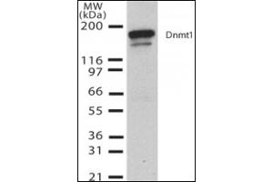 Western Blotting (WB) image for anti-DNA (Cytosine-5)-Methyltransferase 1 (DNMT1) (AA 637-650) antibody (ABIN492452) (DNMT1 antibody  (AA 637-650))