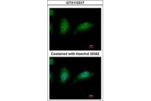 ZNHIT2 antibody  (AA 1-273)