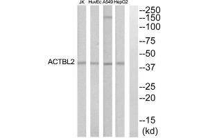 Western blot analysis of extracts from HepG2, HuvEc, Jurkat and A549 cells, using ACTBL2 antibody. (ACTBL2 antibody  (Internal Region))