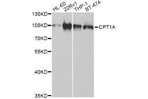 Western blot analysis of extracts of various cell lines, using CPT1A Antibody (ABIN5973053) at 1/1000 dilution. (CPT1A antibody)