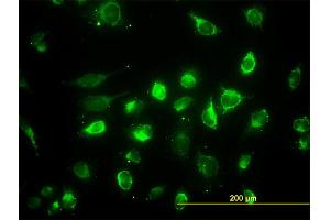 Immunofluorescence of monoclonal antibody to ACAA2 on HeLa cell. (ACAA2 antibody  (AA 151-260))