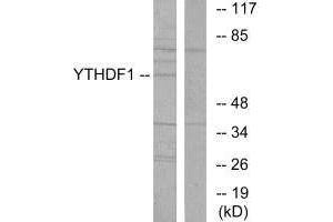 Western blot analysis of extracts from 293 cells, using YTHDF1 antibody. (YTHDF1 antibody  (N-Term))
