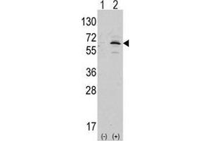 Western blot analysis of APPBP1 (arrow) using rabbit polyclonal APPBP1 Antibody (C-term) (AP13996PU-N ). (NAE1 antibody  (C-Term))