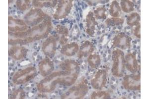 DAB staining on IHC-P; Samples: Mouse Kidney Tissue (CBY1/PGEA1 antibody  (AA 7-127))