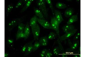 Immunofluorescence of monoclonal antibody to S100B on HeLa cell . (S100B antibody  (AA 1-92))