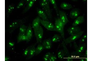 Immunofluorescence of monoclonal antibody to S100B on HeLa cell .