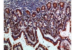 Immunohistochemical analysis of paraffin-embedded human-small-intestine, antibody was diluted at 1:200 (BTLA antibody  (AA 101-150))