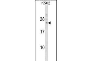 DCAKD Antibody (N-term) (ABIN1539435 and ABIN2849301) western blot analysis in K562 cell line lysates (35 μg/lane). (DCAKD antibody  (N-Term))