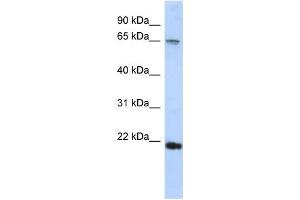 Western Blotting (WB) image for anti-Fibrinogen Silencer Binding Protein (FSBP) antibody (ABIN2457977) (FSBP antibody)