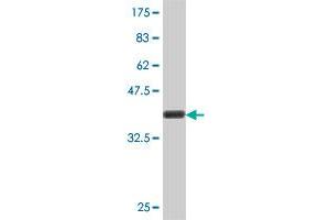 Western Blot detection against Immunogen (37 KDa) . (EPM2A antibody  (AA 101-199))