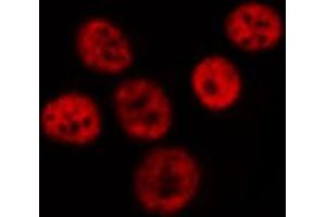 ABIN6267597 staining HeLa by IF/ICC. (NF-kB p65 antibody  (pSer529))