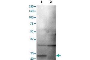 Western blot analysis of HEK293 cells over-expressing SLC2A1 (Lane 1) or a nono-specific control receptor (Lane 2) using CLDN1 polyclonal antibody  at 1:200 dilution. (Claudin 1 antibody)