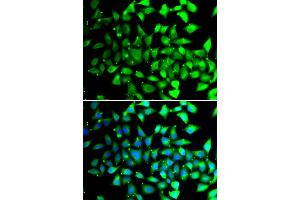 Immunofluorescence analysis of A549 cells using COPS6 antibody. (COPS6 antibody)