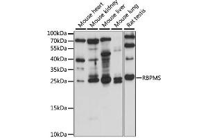 Western blot analysis of extracts of various cell lines, using RBPMS antibody (ABIN7270097) at 1:1000 dilution. (RBPMS antibody  (AA 110-219))