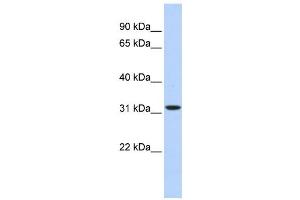 Western Blotting (WB) image for anti-3-hydroxyisobutyrate Dehydrogenase (HIBADH) antibody (ABIN2459627) (HIBADH antibody)