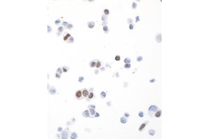 anti-Progesterone Receptor (PGR) antibody
