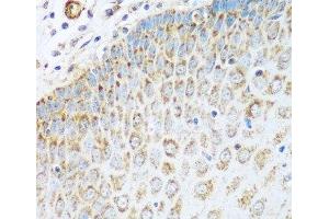 Immunohistochemistry (Paraffin-embedded Sections) (IHC (p)) image for anti-Glutamate Dehydrogenase 1 (GLUD1) antibody (ABIN7263621)