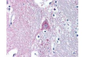 Immunohistochemical (Formalin/PFA-fixed paraffin-embedded sections) staining in human brain (caduate) with MARK1 polyclonal antibody . (MARK1 antibody)