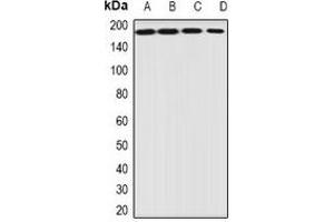 Western blot analysis of EIF3A expression in HepG2 (A), Jurkat (B), mouse heart (C), mouse ovary (D) whole cell lysates.