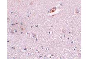 Immunohistochemical staining of human brain tissue with 5 ug/mL ZNF536 polyclonal antibody . (ZNF536 antibody  (N-Term))