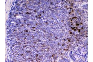 IHC analysis of CD14 using anti-CD14 antibody . (CD14 antibody  (AA 16-260))