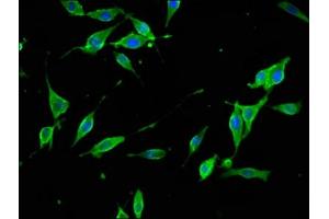 Immunofluorescence staining of NIH/3T3 cells with ABIN7171124 at 1:133, counter-stained with DAPI. (Synaptojanin 1 antibody  (AA 1030-1261))