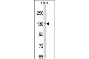 Western blot analysis of C15orf2 Antibody in Hela cell line lysates (35ug/lane)