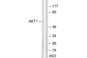Western blot analysis of extracts from NIH/3T3cells, treated with PDGF (50mg /ml, 20mins), using Akt (epitope around residue 124) Antibody. (AKT1 antibody  (Ser124))