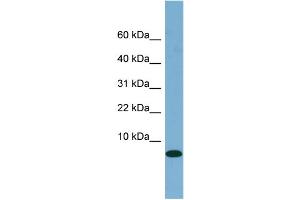 WB Suggested Anti-FABP1 Antibody Titration:  0. (FABP1 antibody  (N-Term))