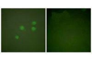 Immunofluorescence analysis of A549 cells, using Cyclin E1 antibody. (Cyclin E1 antibody)