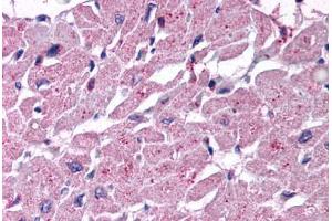 Human Heart (formalin-fixed, paraffin-embedded) stained with CYSLTR2 antibody ABIN213376 at 10 ug/ml followed by biotinylated goat anti-rabbit IgG secondary antibody ABIN481713, alkaline phosphatase-streptavidin and chromogen. (CasLTR2 antibody  (Extracellular Domain))