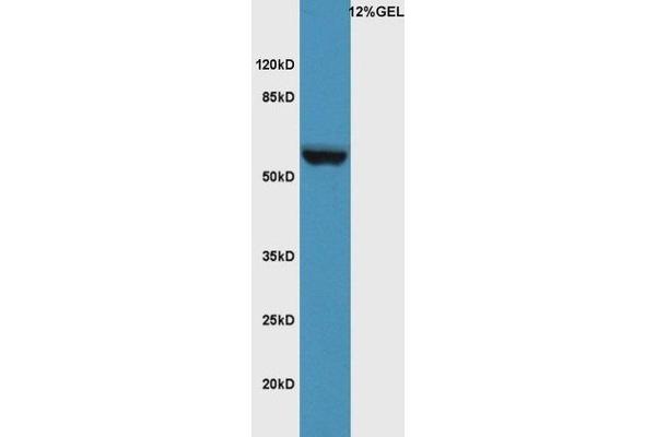 IL20RA antibody  (AA 135-171)