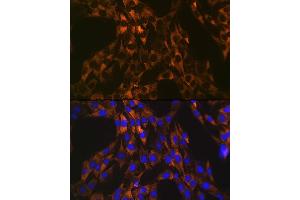 Immunofluorescence analysis of C6 cells using PUMA Rabbit mAb (ABIN1678790, ABIN3018050, ABIN3018051 and ABIN7101572) at dilution of 1:100 (40x lens). (PUMA antibody)