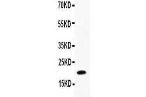Anti-IL12 p40 Picoband antibody,  All lanes: Anti-IL12 P40 at 0. (IL12B antibody  (AA 23-321))